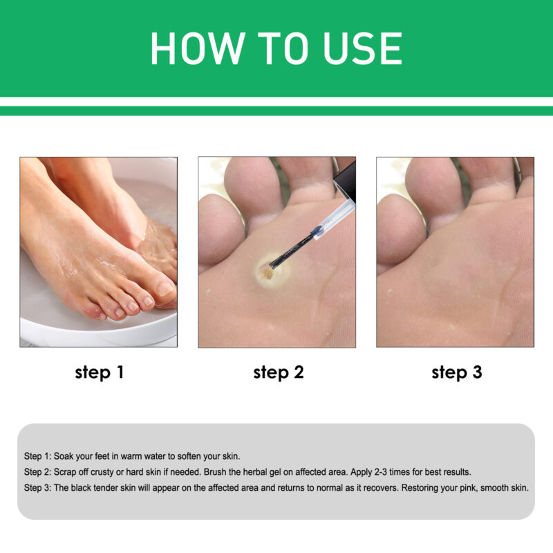 Natural Foot Corns Smoothing Lotion with Herbal Ingredients - Image 5