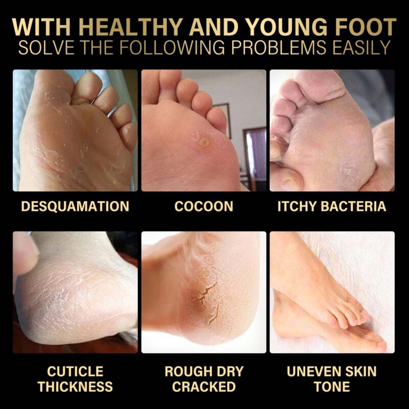 Lavender Foot Mask - Exfoliating & Hydrating Foot Care for Smooth Feet - Image 4