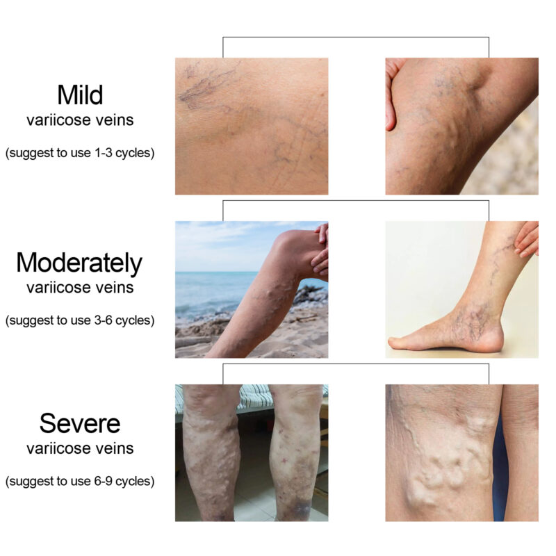 Daily Massage Moisturizing Cream for Leg Care - Soothed Soft Skin - Image 3