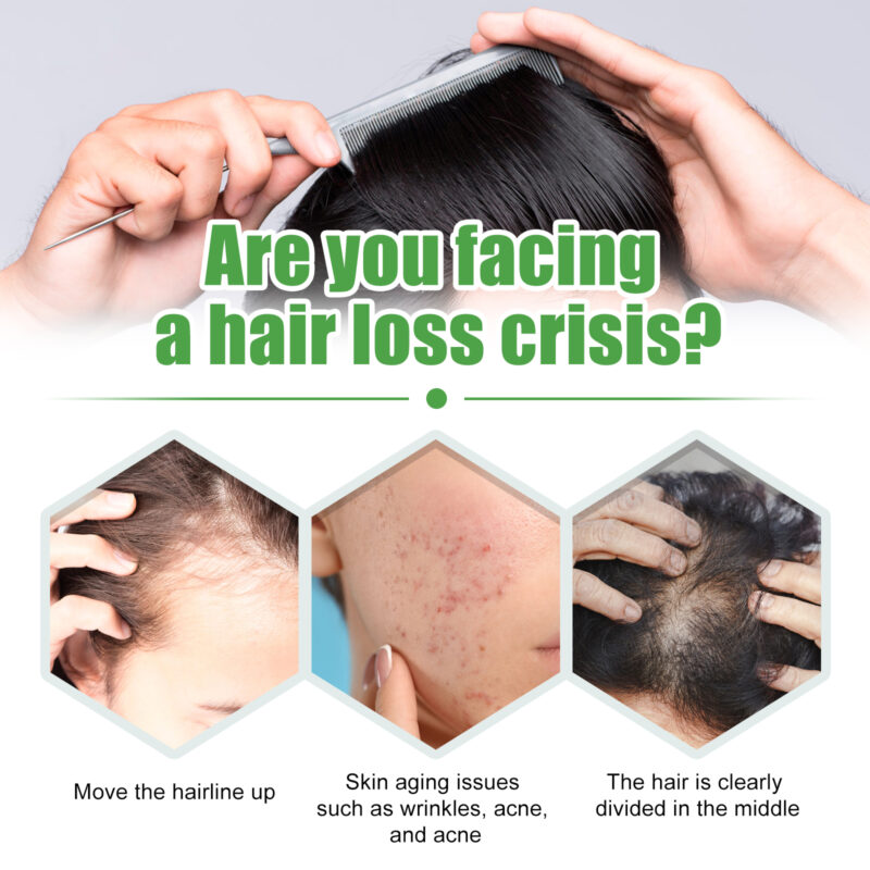 Castor Oil for Hair Care - Moisturize, Protect, Support Density - Image 3