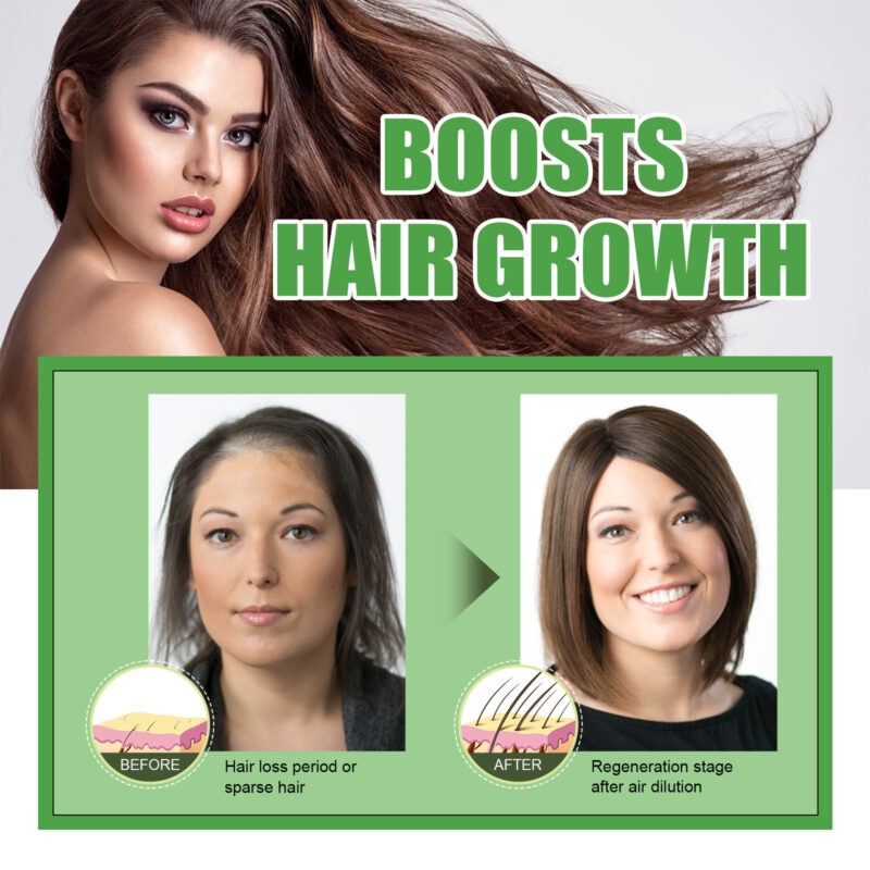 Castor Oil for Hair Care - Moisturize, Protect, Support Density - Image 4