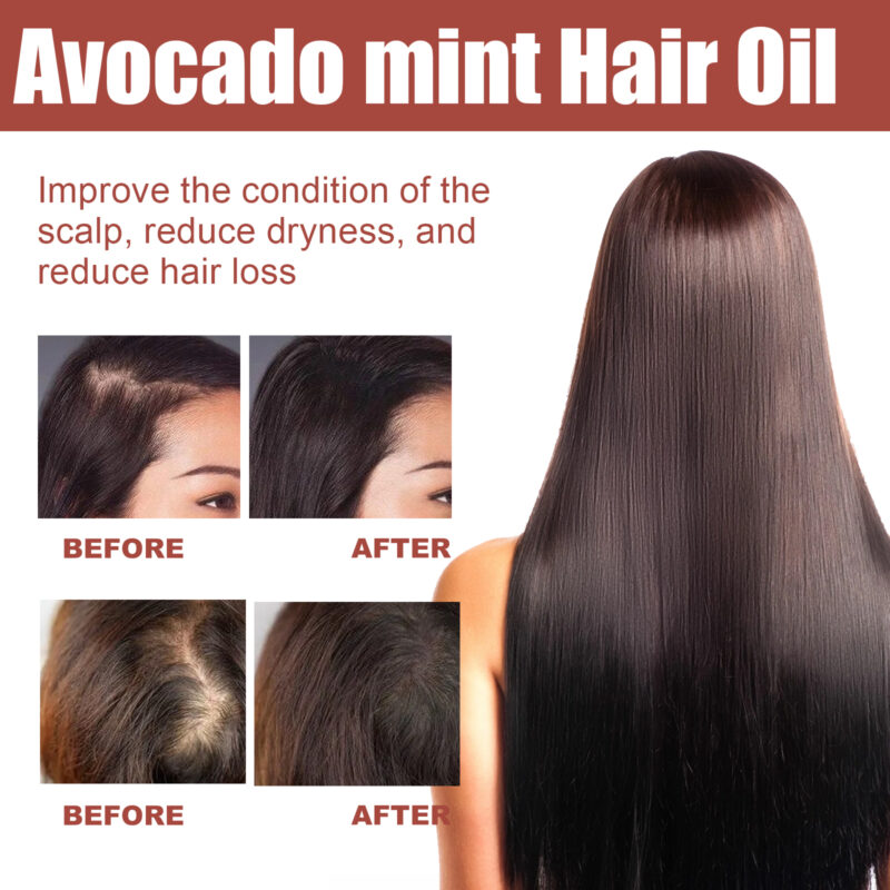 Hair Essential Oil for Dry, Restless Hair Care with Natural Supple Shine - Image 3