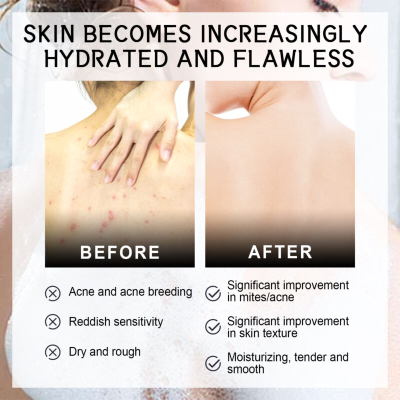 Back Silk Soap - Gentle Body Cleanser for Acne-Prone Skin - Image 4