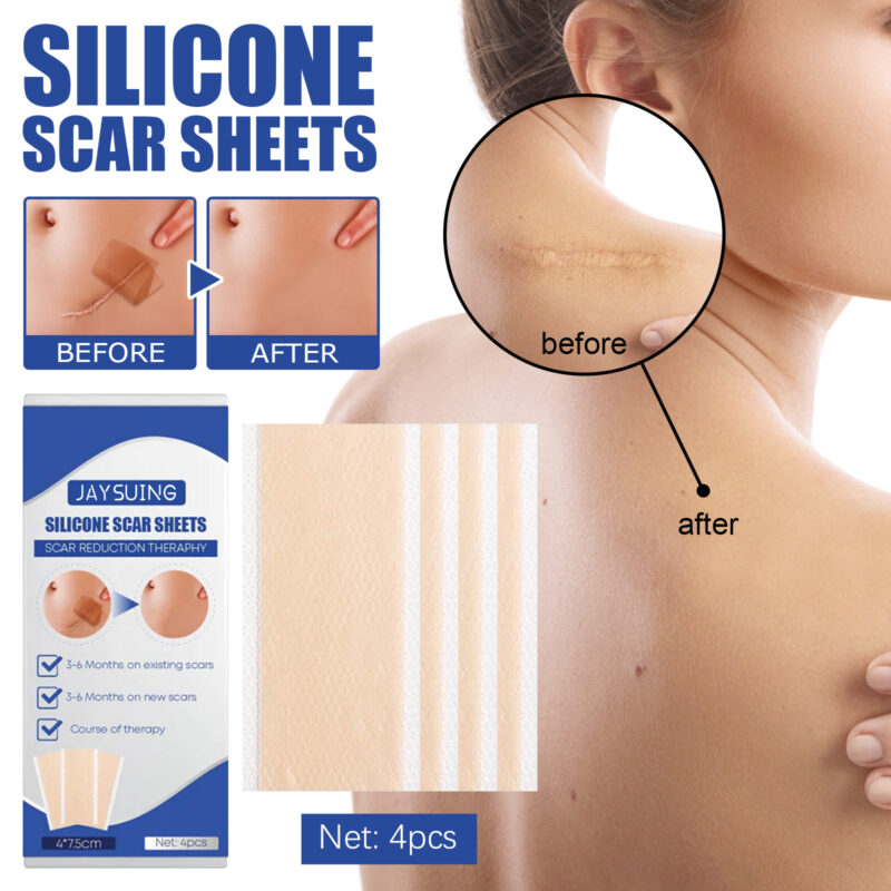 Silicone Scar Tape for Smoother Texture & Skin Comfort - Image 2