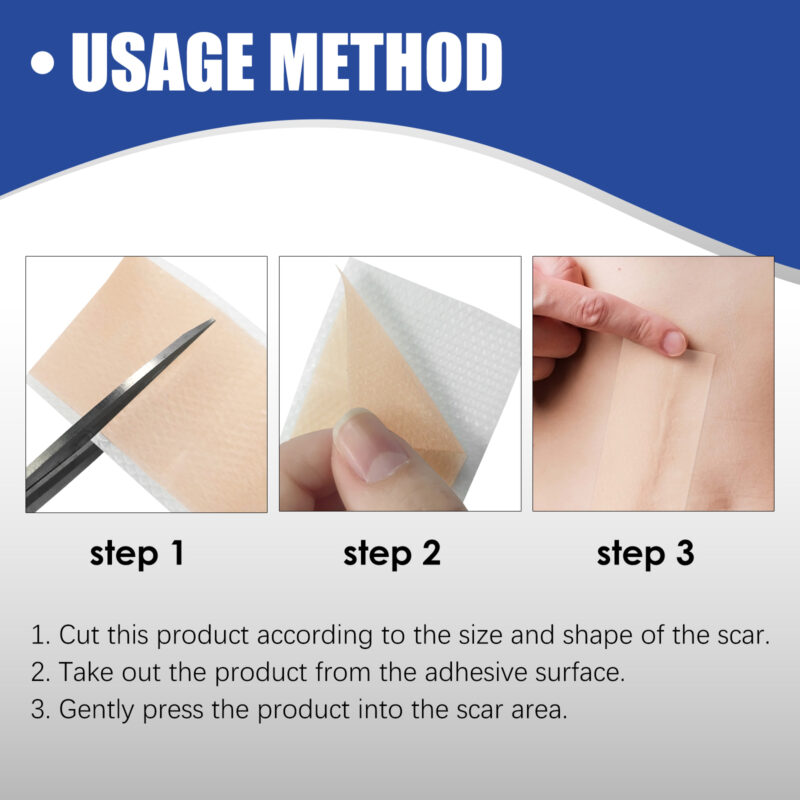 Silicone Scar Tape for Smoother Texture & Skin Comfort - Image 6