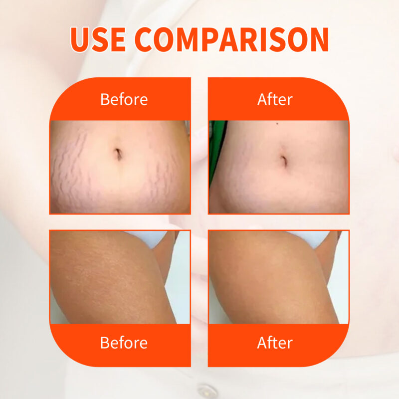 Scar Oil for Skin Moisturizing and Mark Reduction - Image 3
