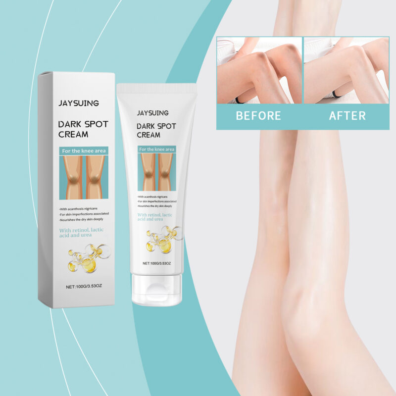 Knee Moisturizing Cream with Lactic Acid & Retinol - Hydrating Skin Care for Soft, Smooth Knees - Image 2