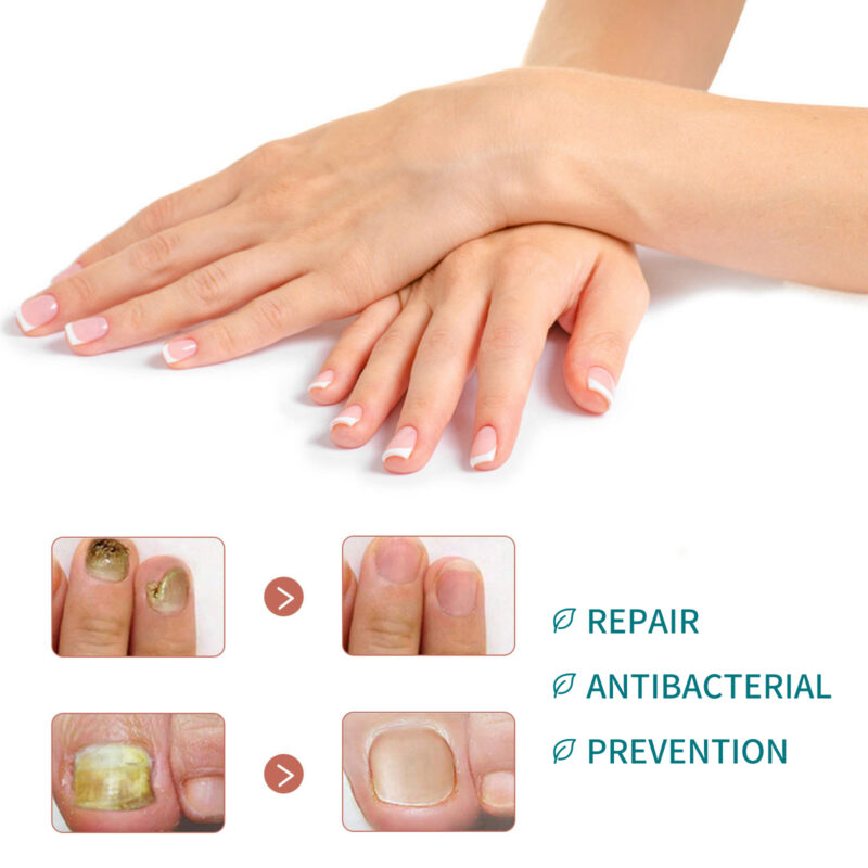 Nail Care Patches for Hands & Feet - Strengthening, Thickening, Brightening Treatment - Image 3