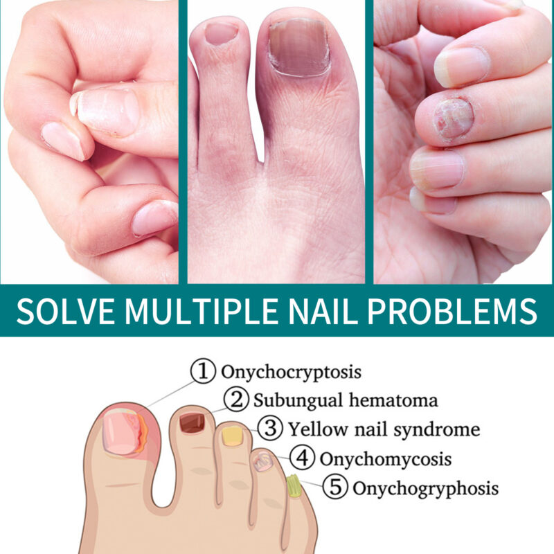 Nail Care Patches for Hands & Feet - Strengthening, Thickening, Brightening Treatment - Image 4