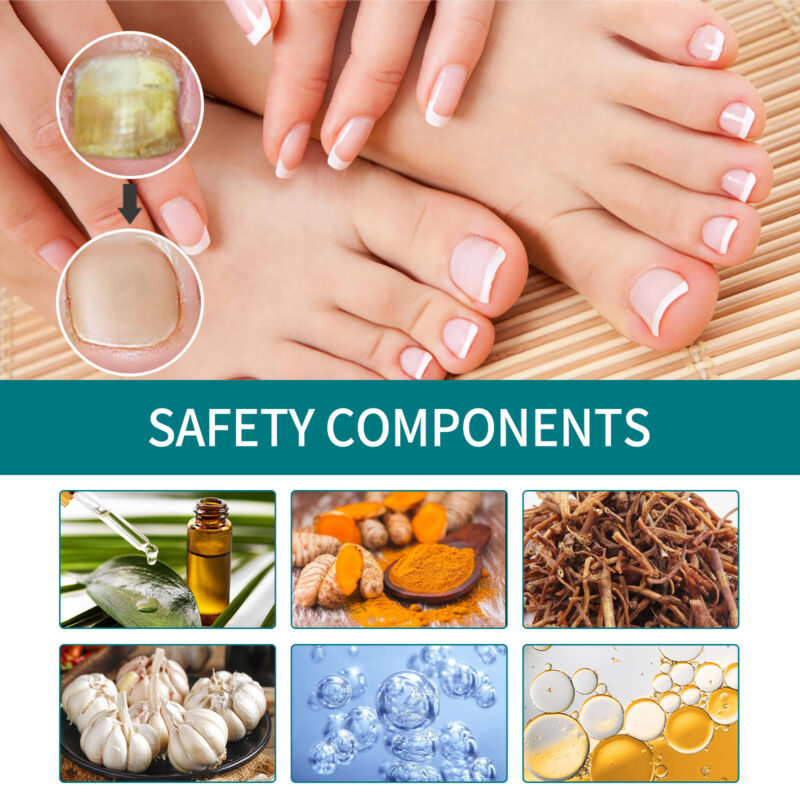 Nail Care Patches for Hands & Feet - Strengthening, Thickening, Brightening Treatment - Image 5