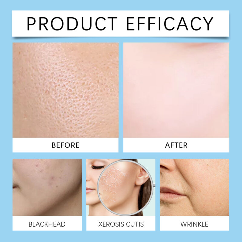 Hyaluronic Acid Serum Hydrating Facial Serum for Smooth Skin & Pore Care - Image 3