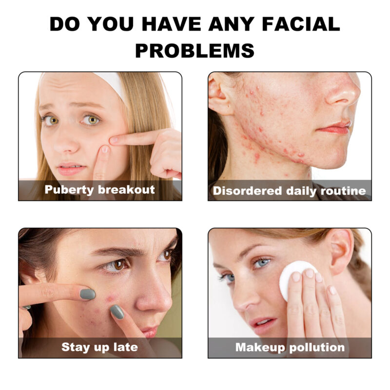 Green Acne Patches - Irregular-Shaped for Daily Pimple Care - Image 3