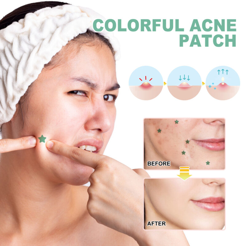 Green Acne Patches - Irregular-Shaped for Daily Pimple Care - Image 4
