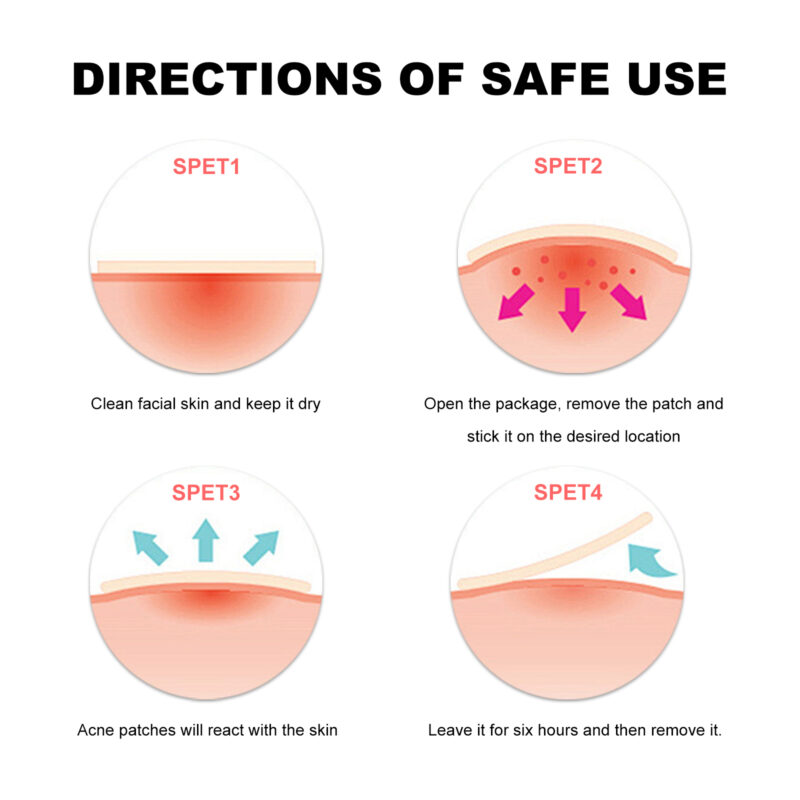 Sea Life Pattern Acne Patches for Concealing, Soothing, and Nourishing Skin - Image 6