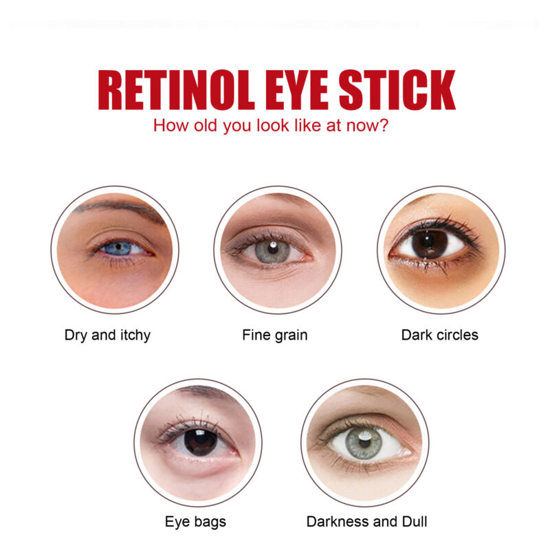 Retinol Eye Stick: Hydrating & Moisturizing for Dark Circles & Puffiness - Image 3