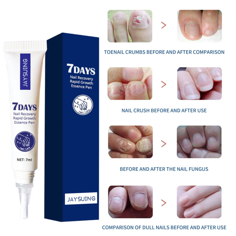 Natural Nail Treatment Essence - Strengthening & Brightening Hand Foot Care - Image 4