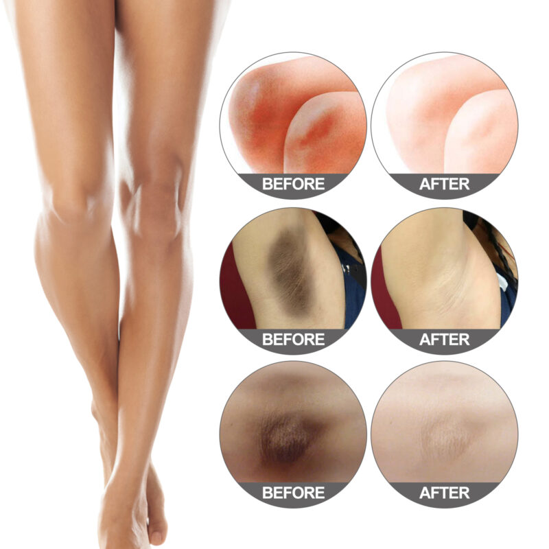 Snow Brightening Body Cream - Hydrating Moisturizer for Underarm, Thigh & Sensitive Areas - Image 3