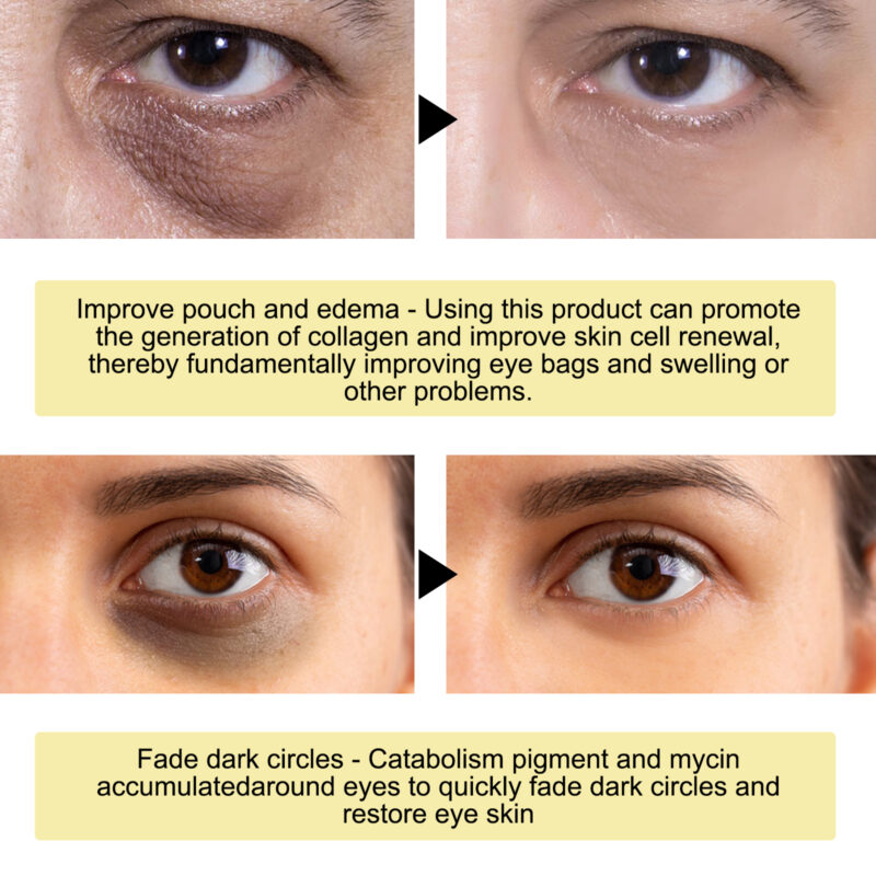 Gold Snail Collagen Eye Mask for Hydration & Under-Eye Care - Image 3