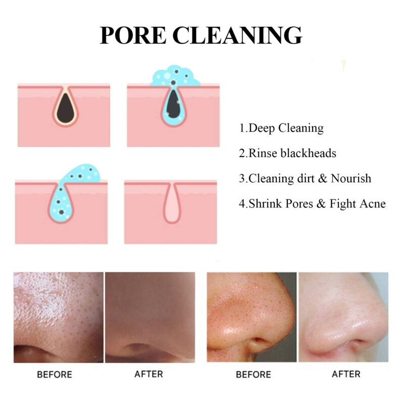 Activated Charcoal Mask Stick for Pore Care & Blackhead Removal - Image 4