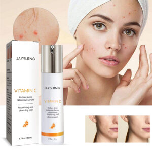 Plant-Based Acne Serum for Acne Marks and Moisturizing Skin Care