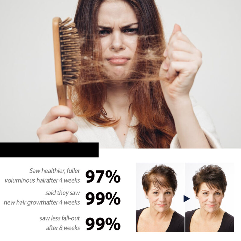 Scalp Scrub - Natural Cleanser for Itchy Scalps & Hair Care - Image 4