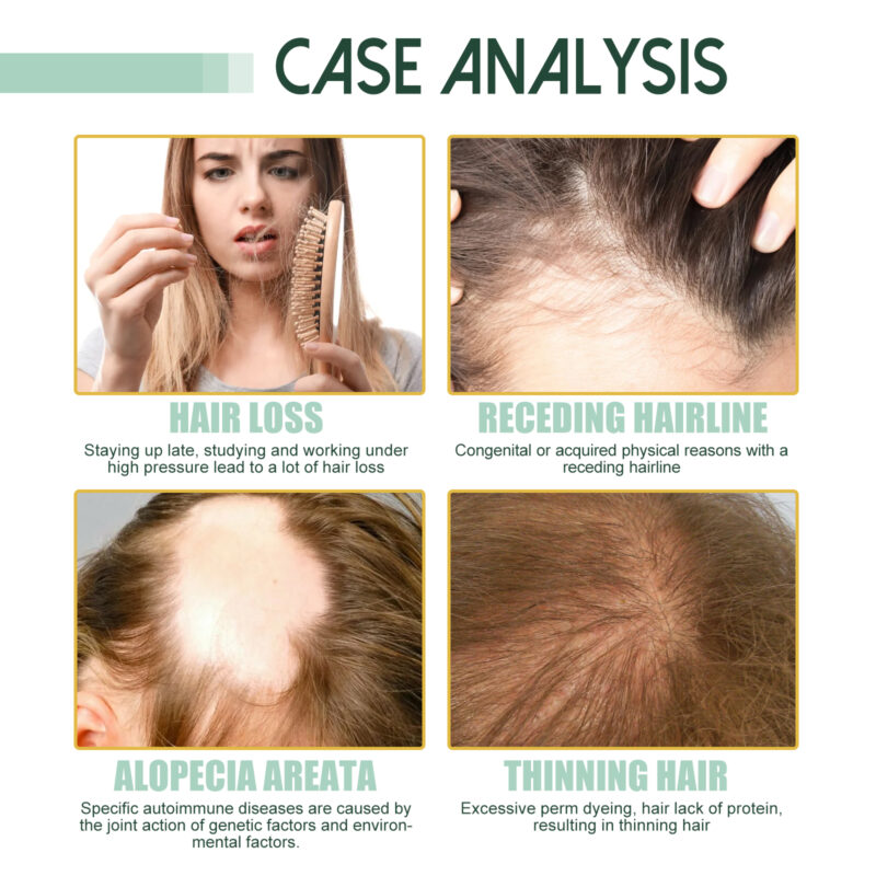 Plant-Based Hair Thickening Serum for Scalp Nourishment & Healthy Hair - Image 3
