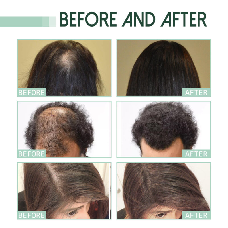 Plant-Based Hair Thickening Serum for Scalp Nourishment & Healthy Hair - Image 4