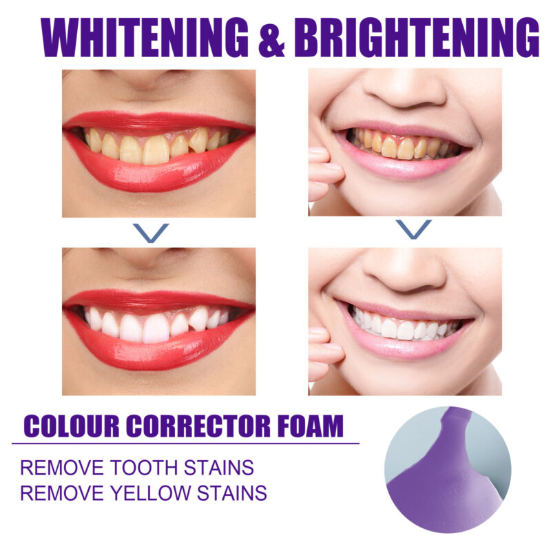 v34 Brightening Toothpaste | Gentle Teeth Whitening & Stain Removal for Daily Oral Care - Image 3