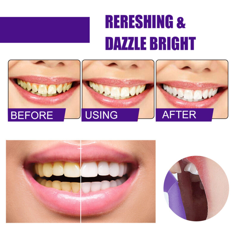 v34 Brightening Toothpaste | Gentle Teeth Whitening & Stain Removal for Daily Oral Care - Image 4
