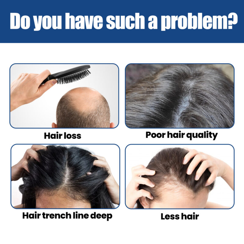 Hair Nourishing Serum with Natural Ingredients - Scalp Care & Thickening Treatment - Image 3