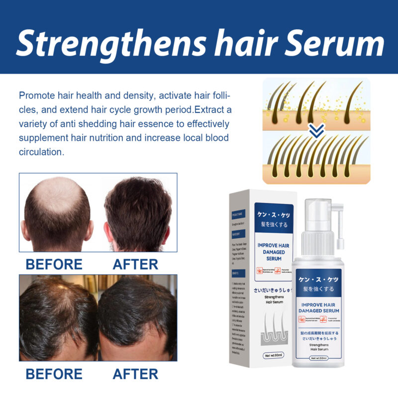 Hair Nourishing Serum with Natural Ingredients - Scalp Care & Thickening Treatment - Image 4
