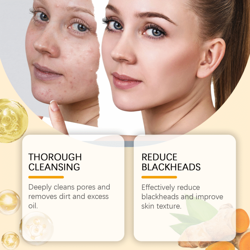 Turmeric Cleanser - Gentle Facial Wash with Oil Control & Moisture Balance - Image 3