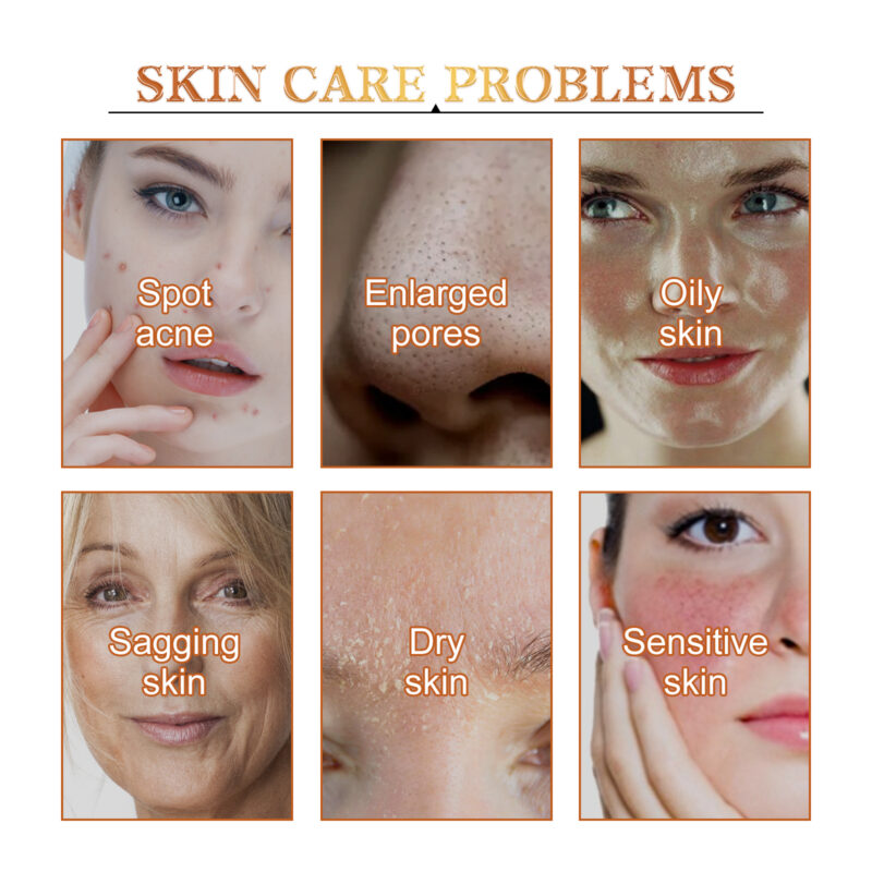 Calendula Peel Mask - Brightening, Oil Control & Gentle Exfoliating Pore Care - Image 3