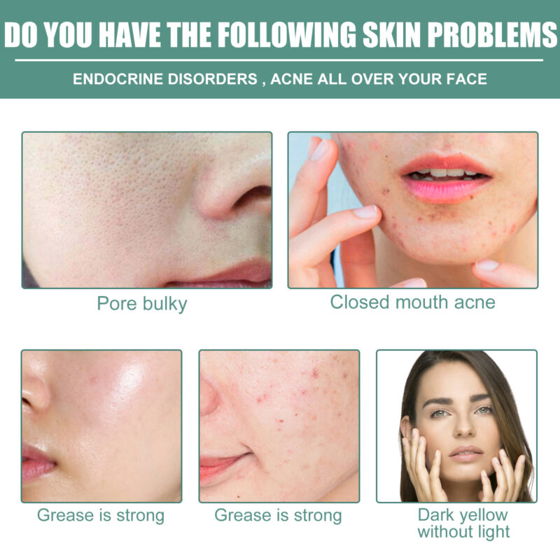 Retinol Serum, Facial Firming, Brightening & Pore Minimizing - Image 3