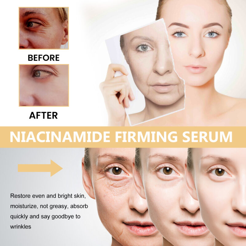Nicotinamide Firming Serum, Moisturize Firm & Brighten Facial Skin - Image 3