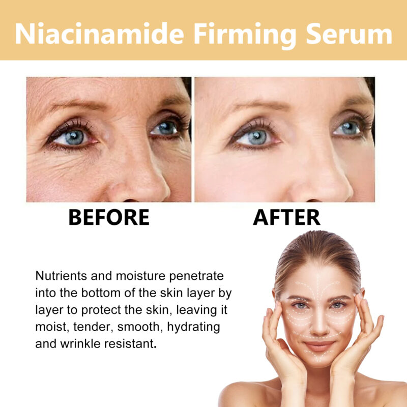 Nicotinamide Firming Serum, Moisturize Firm & Brighten Facial Skin - Image 4