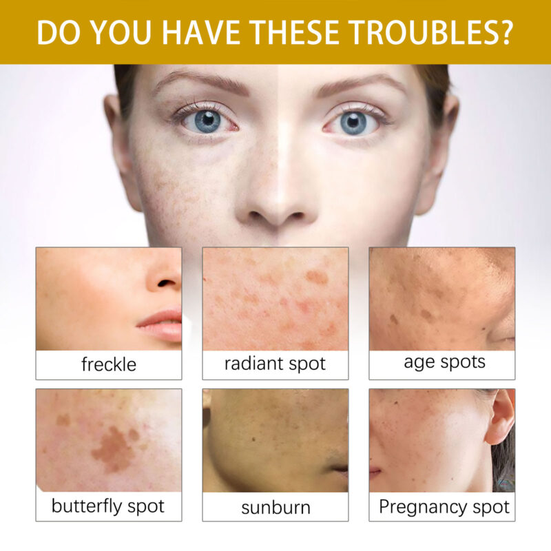 Spot Lightening Serum - Natural Melanin Support Facial Oil - Image 3