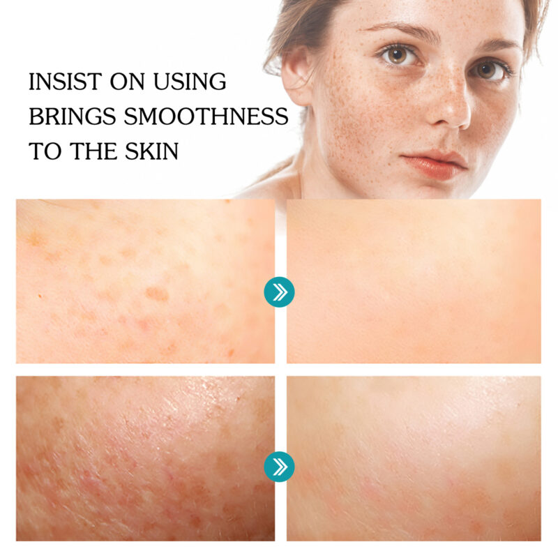 Niacinamide Serum for Brightening, Pore Minimizing, Hydrated Skin - Image 4