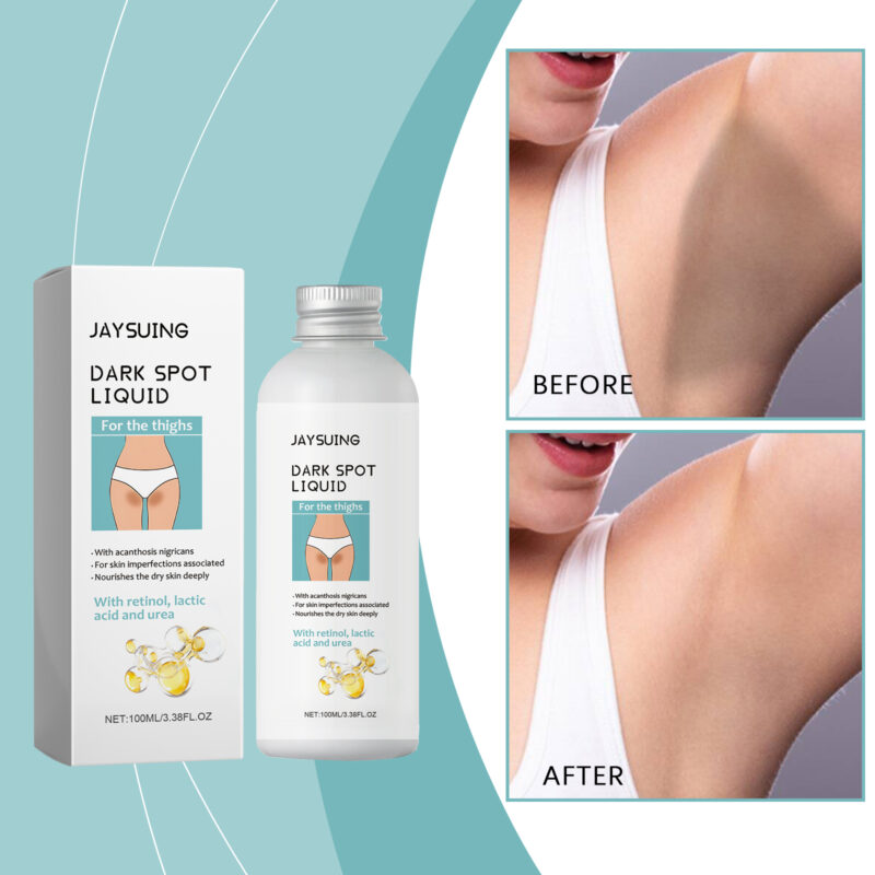 Leg Nourishing Hydrating Lotion for Inner Thighs & Skin Glow - Image 2
