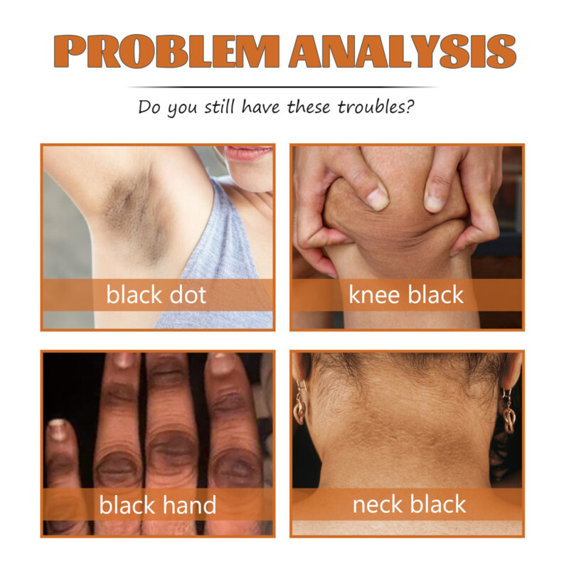 Acanthosis Nigricans Repair Oil | Moisturizing Treatment for Dark Armpits, Knees & Elbows - Image 4