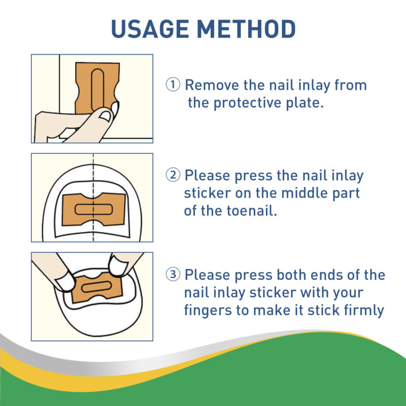 Toenail Correction Patch - Gentle Alignment for Natural Nail Care - Image 5