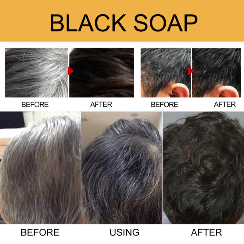 Black Shampoo Soap for Hair Care - Clean Scalp, Supple & Strong Hair - Image 3