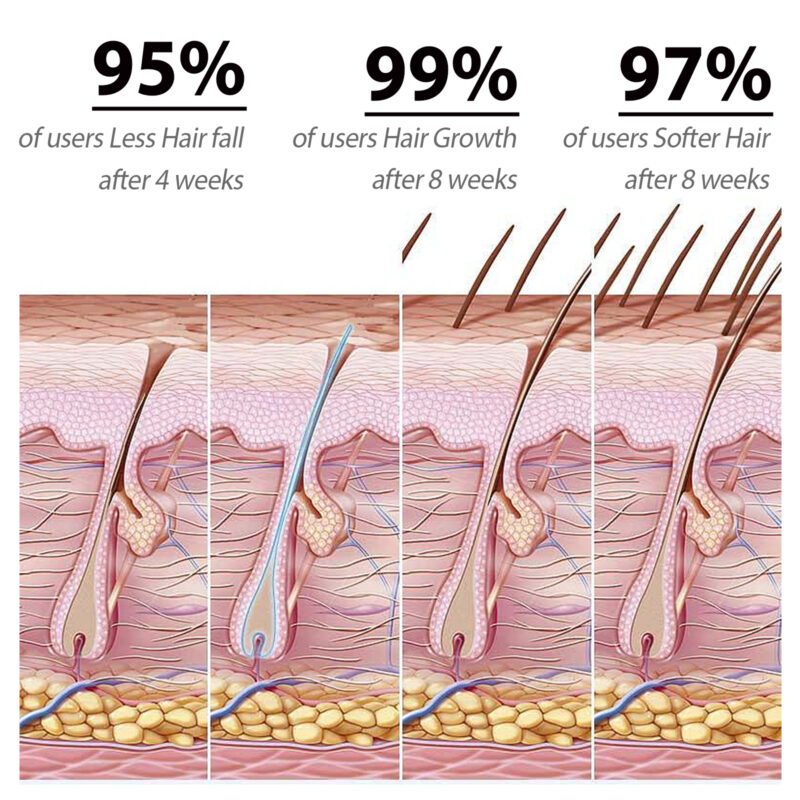 Amino Acid Shampoo – Deep Clean Scalp, Strengthen Hair, Gentle Care - Image 3